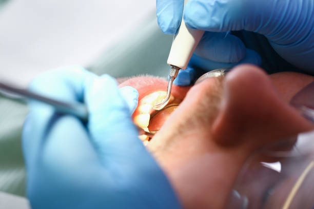 Best Mobile Emergency Dentist in Quartz Hill, CA